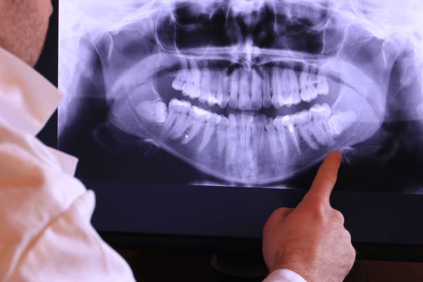 Best Dentist for Tooth Abscess  in Archer Lodge, NC