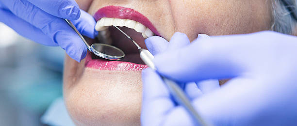 Best Chipped Tooth Repair Near Me  in Archer Lodge, NC