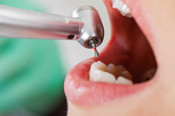 Best Chipped Tooth Repair Near Me  in Archer Lodge, NC